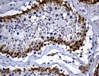 Immunohistochemistry (Formalin/PFA-fixed paraffin-embedded sections) - Anti-DHRS4L2 antibody [OTI4A10] (AB236380)