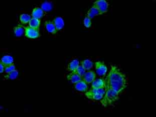 Immunocytochemistry/ Immunofluorescence - Anti-DHRS7 antibody [EPR9338(B)] (AB140596)
