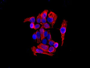 Immunocytochemistry/ Immunofluorescence - Anti-DHRS7 antibody [EPR9338(B)] (AB140596)