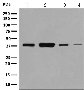 Western blot - Anti-DHRS7 antibody [EPR9338(B)] (AB140596)
