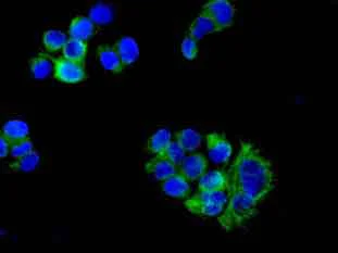 Immunocytochemistry/ Immunofluorescence - Anti-DHRS7 antibody [EPR9338(B)] - BSA and Azide free (AB248892)