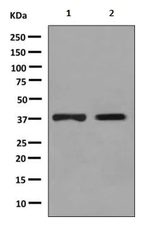 Western blot - Anti-DHRS7 antibody [EPR9339(B)] (AB156021)