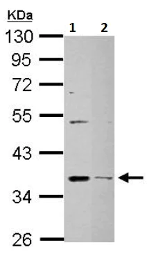 Western blot - Anti-DHRS9 antibody (AB126074)