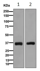 Western blot - Anti-DHRSX antibody [EPR7753(2)] - BSA and Azide free (AB249641)