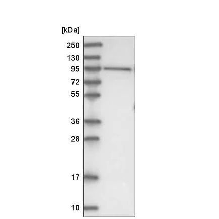 Western blot - Anti-DHTKD1 antibody (AB220098)
