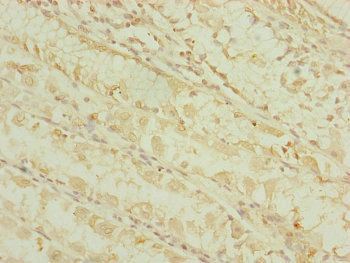 Immunohistochemistry (Formalin/PFA-fixed paraffin-embedded sections) - Anti-DHTKD1 antibody (AB230392)