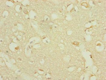 Immunohistochemistry (Formalin/PFA-fixed paraffin-embedded sections) - Anti-DHTKD1 antibody (AB230392)