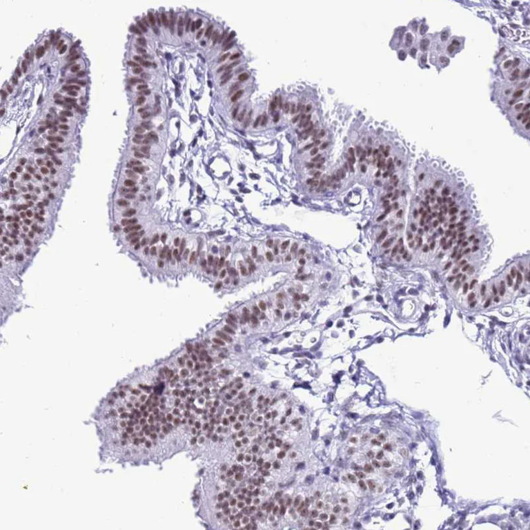 Immunohistochemistry (Formalin/PFA-fixed paraffin-embedded sections) - Anti-DHX15/prp43 antibody (AB254591)