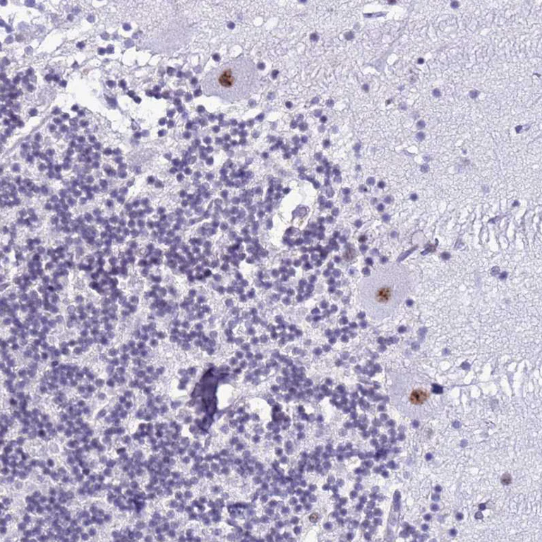 Immunohistochemistry (Formalin/PFA-fixed paraffin-embedded sections) - Anti-DHX15/prp43 antibody (AB254591)