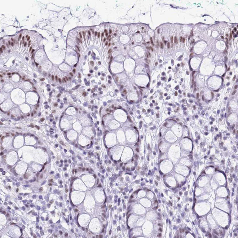 Immunohistochemistry (Formalin/PFA-fixed paraffin-embedded sections) - Anti-DHX15/prp43 antibody (AB254591)