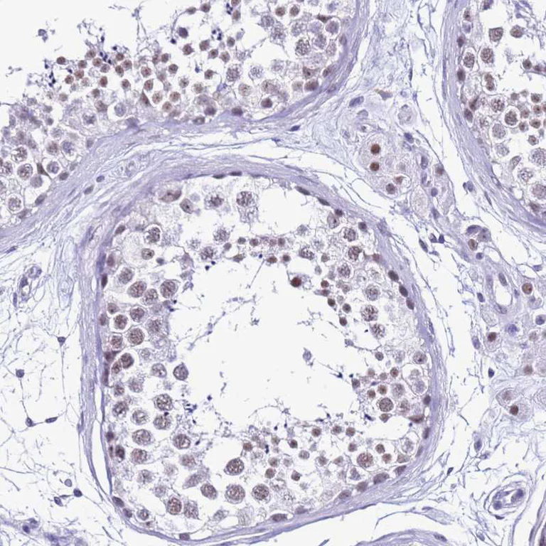 Immunohistochemistry (Formalin/PFA-fixed paraffin-embedded sections) - Anti-DHX15/prp43 antibody (AB254591)