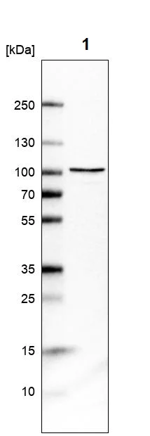 Western blot - Anti-DHX15/prp43 antibody (AB254591)