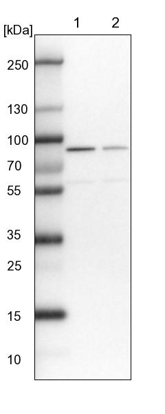 Western blot - Anti-DHX15/prp43 antibody (AB254591)