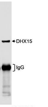 Immunoprecipitation - Anti-DHX15/prp43 antibody (AB70454), expandable thumbnail