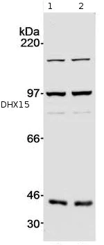 Western blot - Anti-DHX15/prp43 antibody (AB70454)