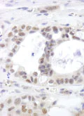 Immunohistochemistry (Formalin/PFA-fixed paraffin-embedded sections) - Anti-DHX15/prp43 antibody (AB85028)