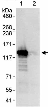 Immunoprecipitation - Anti-DHX16 antibody (AB176819)