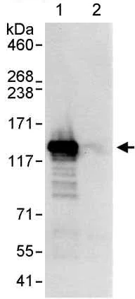 Immunoprecipitation - Anti-DHX16 antibody (AB176819)