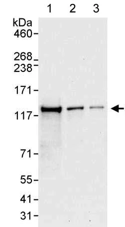 Western blot - Anti-DHX16 antibody (AB176819)