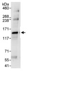 Immunoprecipitation - Anti-DHX30 antibody (AB85687), expandable thumbnail