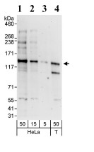 Western blot - Anti-DHX30 antibody (AB85687), expandable thumbnail
