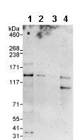 Western blot - Anti-DHX30 antibody (AB85754)
