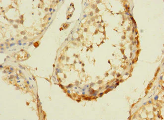 Immunohistochemistry (Formalin/PFA-fixed paraffin-embedded sections) - Anti-DHX32 antibody (AB235100)