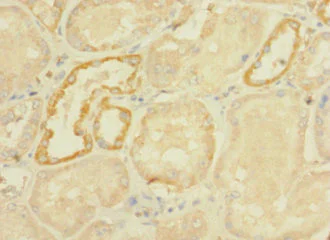 Immunohistochemistry (Formalin/PFA-fixed paraffin-embedded sections) - Anti-DHX32 antibody (AB235100)
