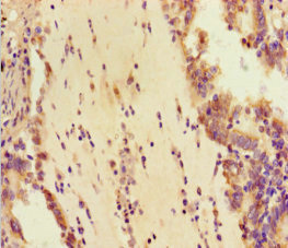 Immunohistochemistry (Formalin/PFA-fixed paraffin-embedded sections) - Anti-DHX33 antibody (AB236794), expandable thumbnail