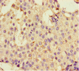 Immunohistochemistry (Formalin/PFA-fixed paraffin-embedded sections) - Anti-DHX33 antibody (AB236794), expandable thumbnail
