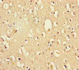 Immunohistochemistry (Formalin/PFA-fixed paraffin-embedded sections) - Anti-DHX35 antibody (AB235366)