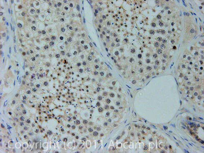 Immunohistochemistry (Formalin/PFA-fixed paraffin-embedded sections) - Anti-DHX36 antibody (AB70269)