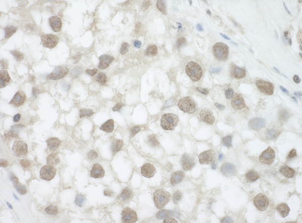 dhx36-antibody-ab70269--