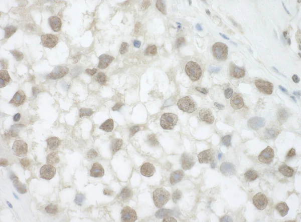 Immunohistochemistry (Formalin/PFA-fixed paraffin-embedded sections) - Anti-DHX36 antibody (AB70269)