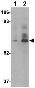 Western blot - Anti-DHX58/RLR antibody (AB67270)