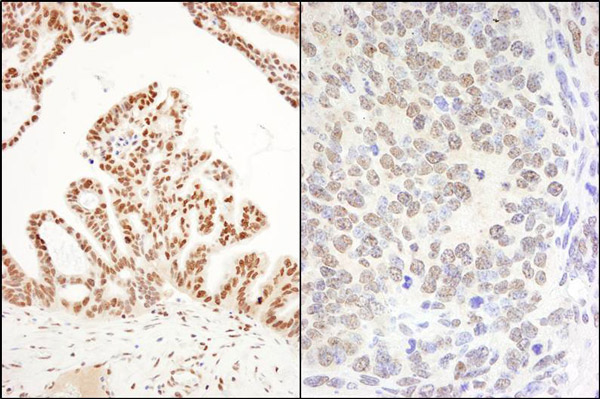 Immunohistochemistry (Formalin/PFA-fixed paraffin-embedded sections) - Anti-DHX8/prp22 antibody (AB70588)