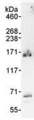 Immunoprecipitation - Anti-DHX8/prp22 antibody (AB70588)