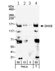 Western blot - Anti-DHX8/prp22 antibody (AB70588)