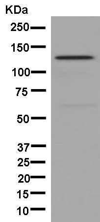Western blot - Anti-DHX8/prp22 antibody [EPR9146(2)] (AB181074)