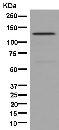 Western blot - Anti-DHX8/prp22 antibody [EPR9146(2)] - BSA and Azide free (AB246344), expandable thumbnail