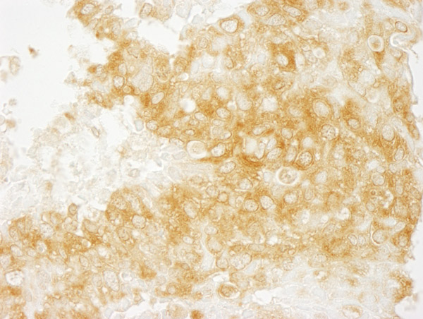 Immunohistochemistry (Formalin/PFA-fixed paraffin-embedded sections) - Anti-DIAPH1 antibody (AB11173), expandable thumbnail