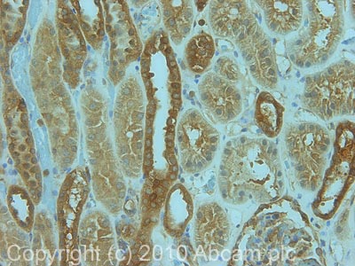 Immunohistochemistry (Formalin/PFA-fixed paraffin-embedded sections) - Anti-DIAPH1 antibody (AB11173), expandable thumbnail