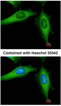 Immunocytochemistry/ Immunofluorescence - Anti-DIAPH1 antibody (AB96784)