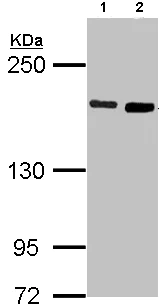 Western blot - Anti-DIAPH1 antibody (AB96784)