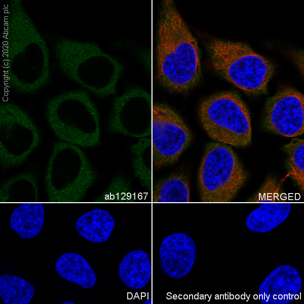 Immunocytochemistry/ Immunofluorescence - Anti-DIAPH1 antibody [EPR7948] (AB129167), expandable thumbnail