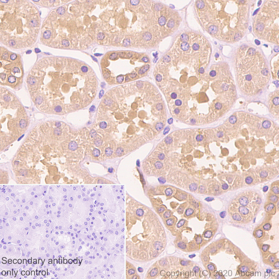 Immunohistochemistry (Formalin/PFA-fixed paraffin-embedded sections) - Anti-DIAPH1 antibody [EPR7948] (ab129167), expandable thumbnail