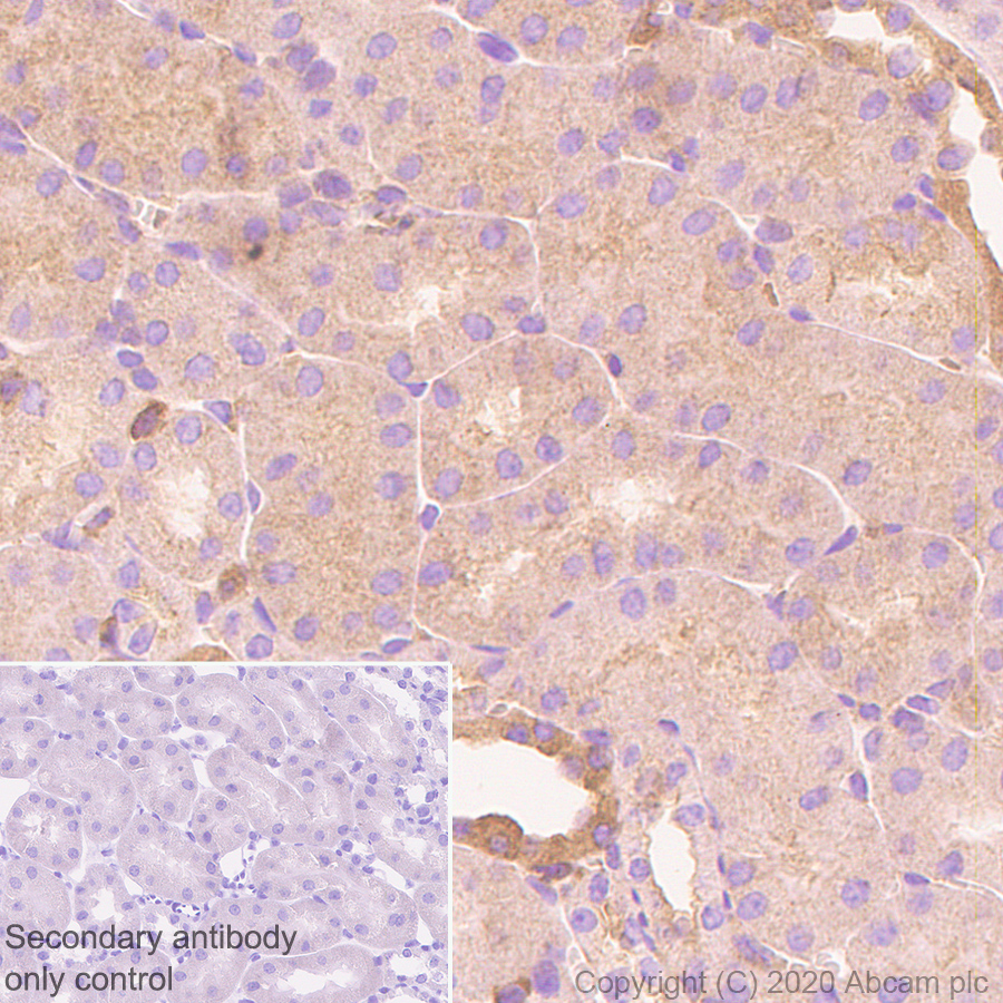 Immunohistochemistry (Formalin/PFA-fixed paraffin-embedded sections) - Anti-DIAPH1 antibody [EPR7948] (ab129167), expandable thumbnail