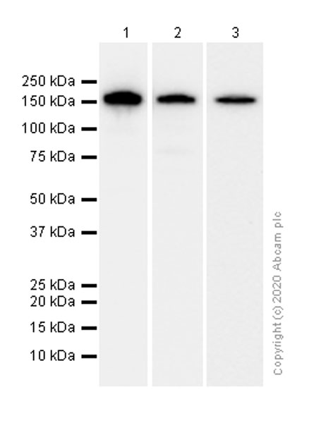 Western blot - Anti-DIAPH1 antibody [EPR7948] (AB129167), expandable thumbnail