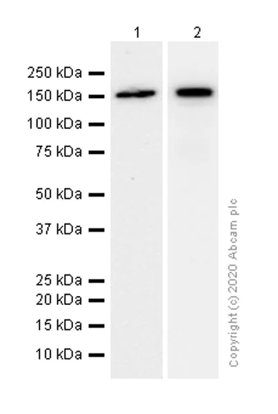 Western blot - Anti-DIAPH1 antibody [EPR7948] (AB129167)
