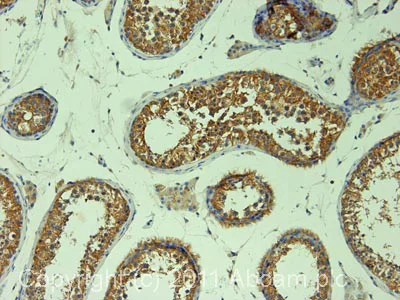 Immunohistochemistry (Formalin/PFA-fixed paraffin-embedded sections) - Anti-DIAPH2/DIA antibody (AB12319)